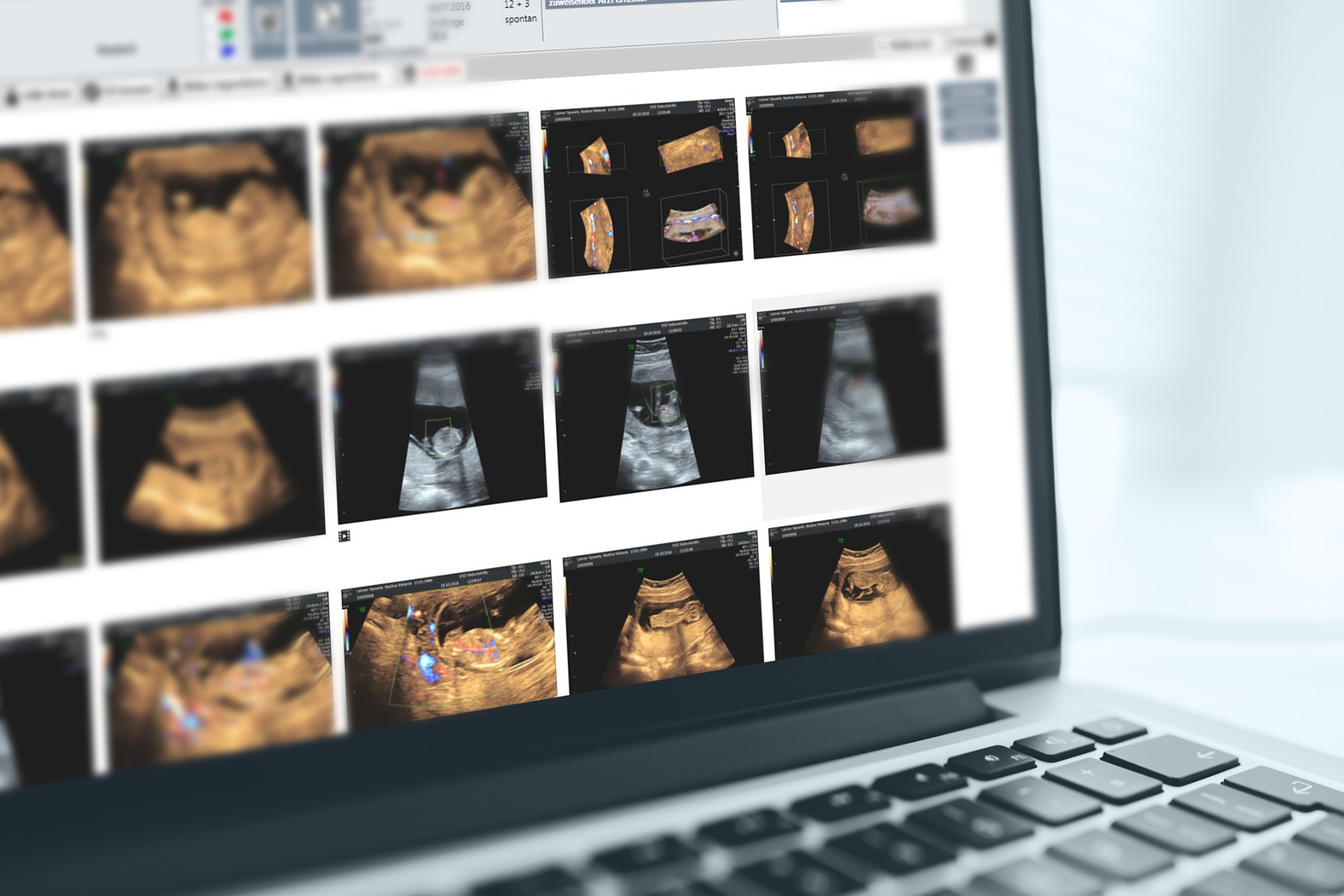 Digisono image archive with ultrasound images