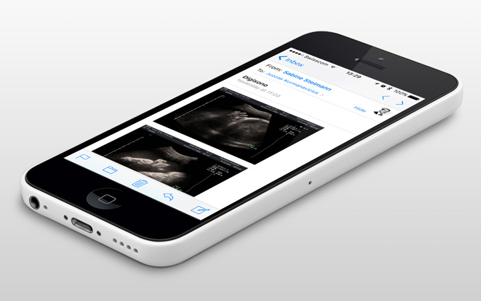 Ultrasound images viewed on a smartphone